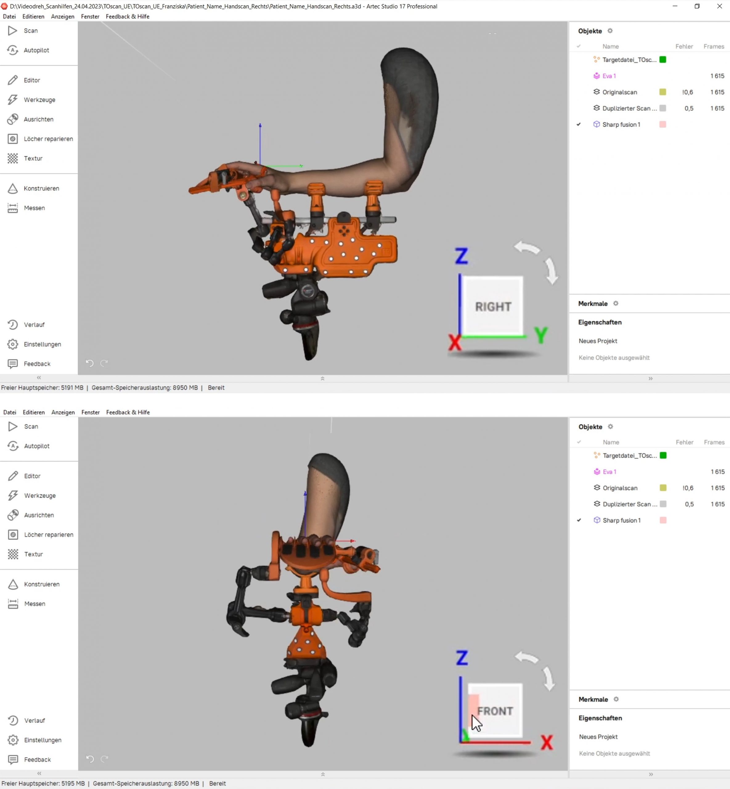 3D-Scan vom Scanwerkzeug mit Patientenarm dargestellt in der Scansoftware Artec Studio