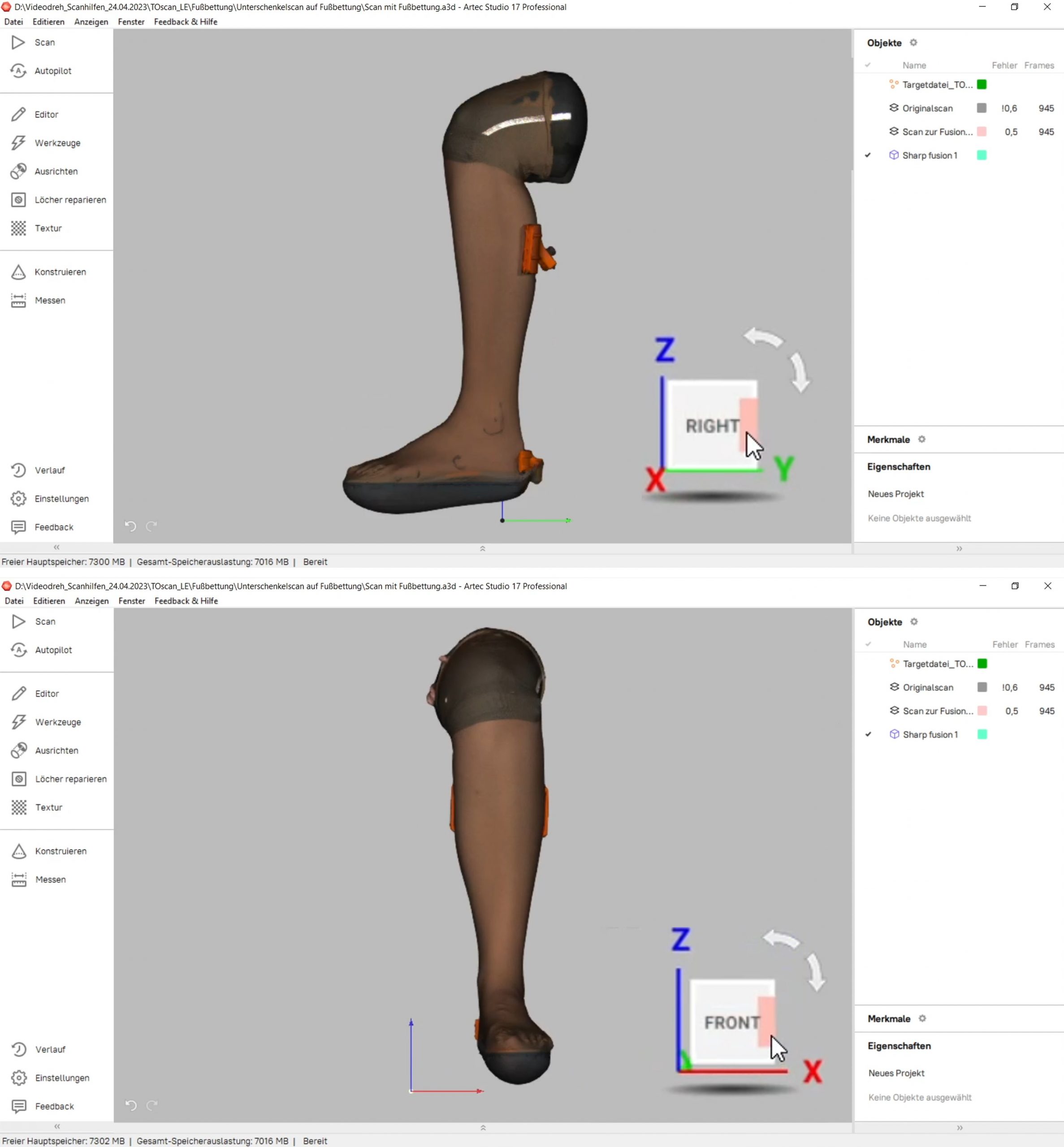3D-gecannter Unterschenkel nach dem Fusionieren in der Software Artec Studio