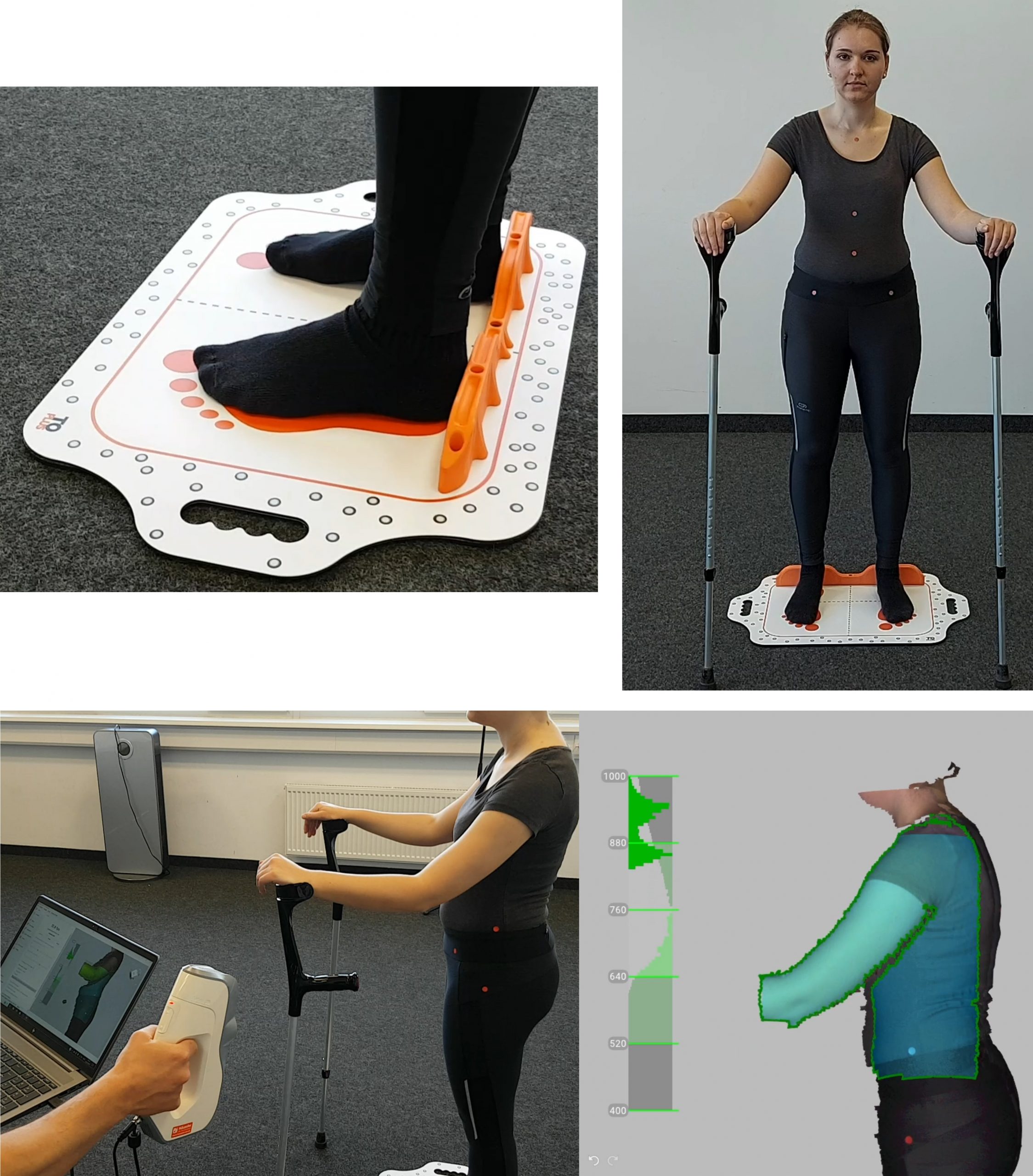 Positionierung des Patienten auf dem Scanwerkzeug TOscan-Body und anschließender 3D-Scan