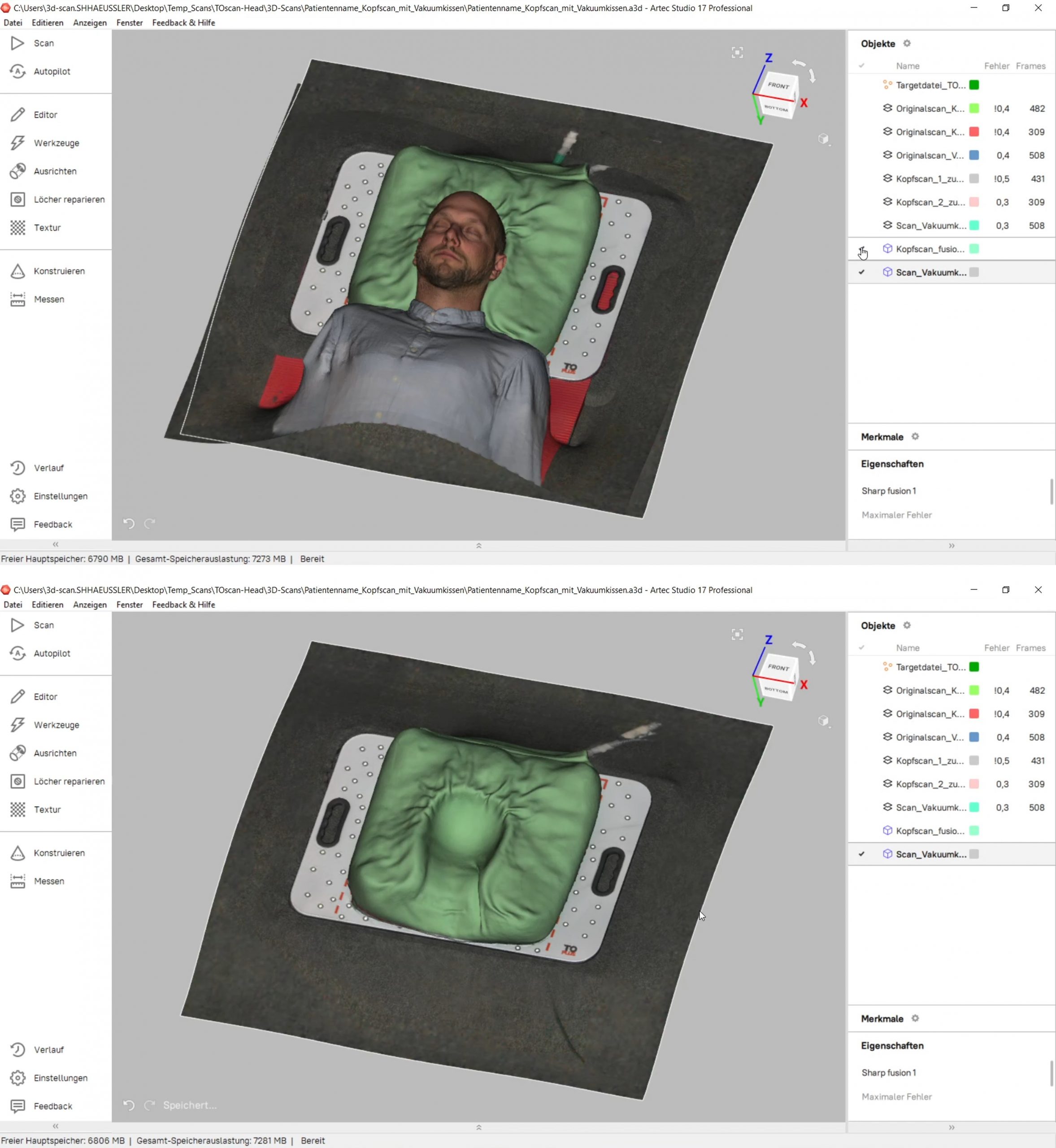 Fusionierter 3D-Scan des Kopfes und des Vakuumkissens in der Software Artec Studio