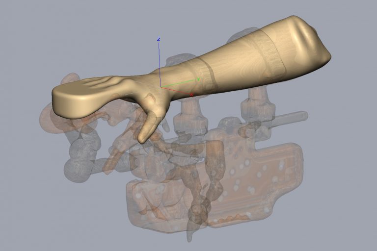 Kapitelbild: 3D-Scan mit Positionierungshilfe